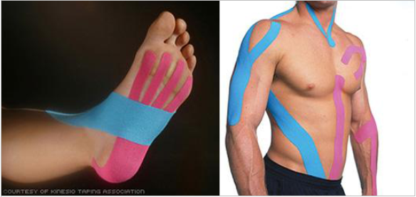 Kinesio Taping Marietta, GA 