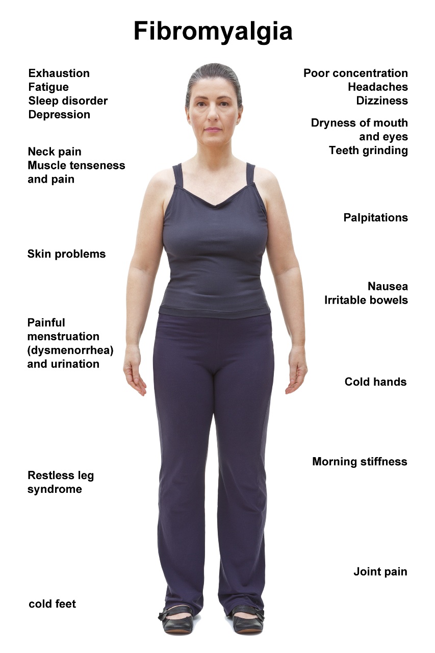 Fibromyalgia Treatment Marietta GA